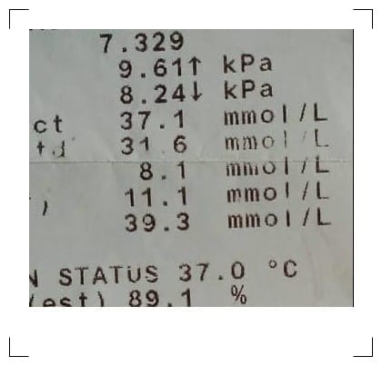 Mentally Predict ABG Results